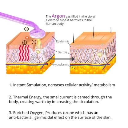 High-Frequency Facial Wand for Acne & Wrinkles.