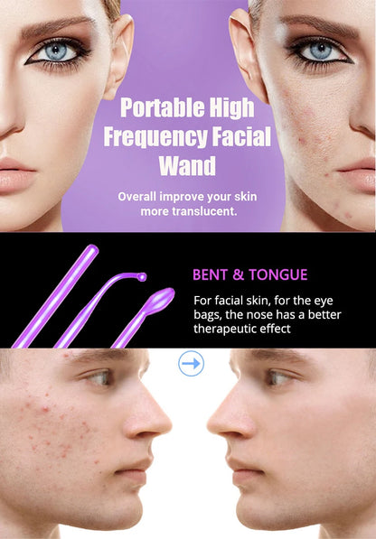 High-Frequency Facial Wand for Acne & Wrinkles.